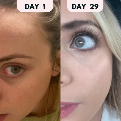 Eyelash & Eyebrow Boosting Serum - 3ml - LashAura™